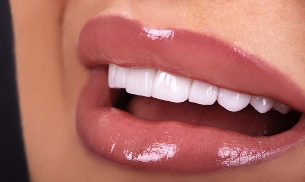 Smile Makeover Options:   Treatments To Achieve A Better Smile
